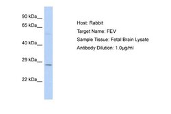 Pet1 Rabbit anti-Human, Polyclonal, Novus Biologicals 0.1ml; Unconjugated:Antibodies,